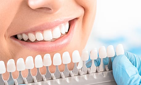 Porcelain Veneers | Creditview Dental | Mississauga Dentist