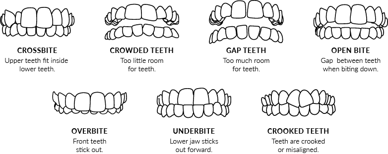 Clear Aligners Smile Assessment | Mississauga Dentist | Credditview Dental