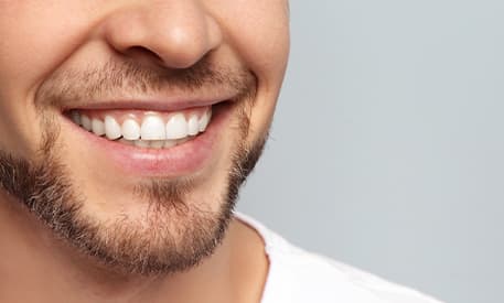 Teeth Whitening | Creditview Dental | Mississauga Dentist